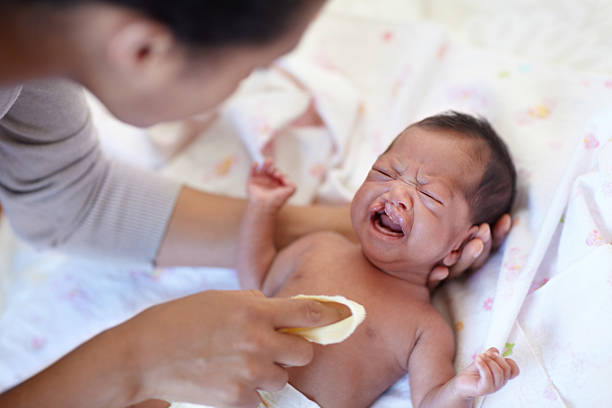 cleft lip surgery