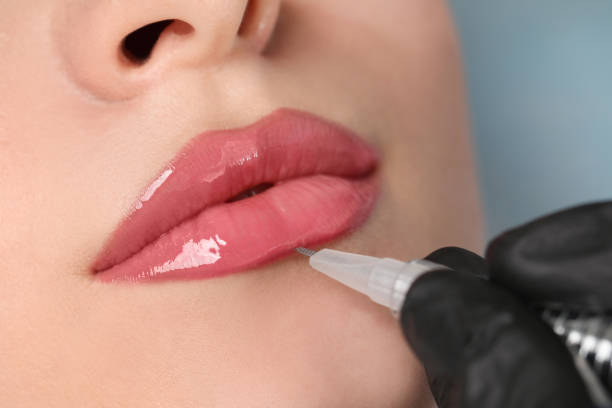 lip lightening treatment
