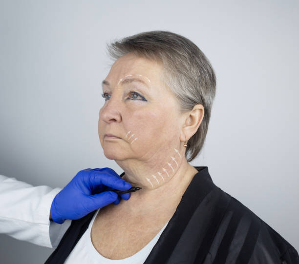 Best Non-Surgical Procedure for Neck Tightening