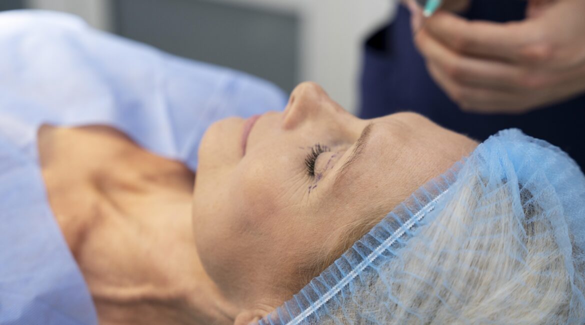 Migraine treatment