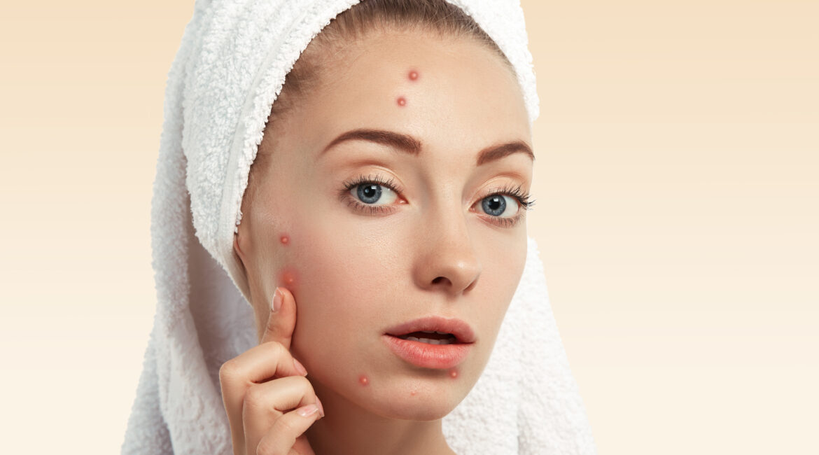 Laser Scar Removal in Bangalore