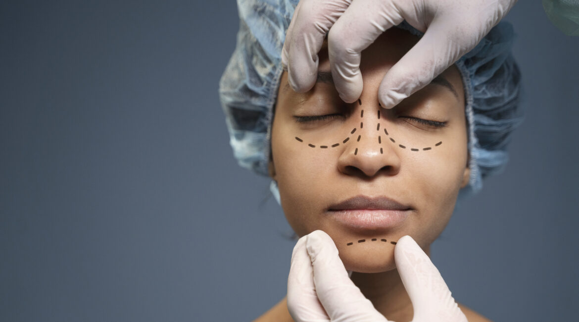 Facelift Surgery
