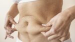 Abdominoplasty Cost in Bangalore – Complete Guide to Tummy Tuck Surgery & Pricing