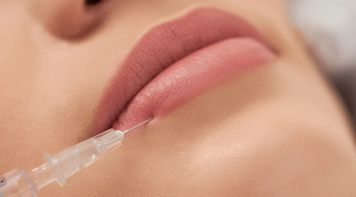 best lip fillers in bangalore